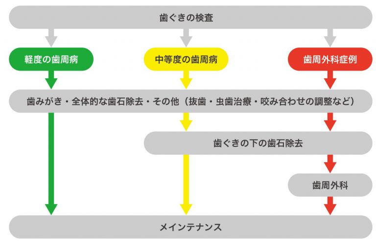 歯周病の治療の流れ